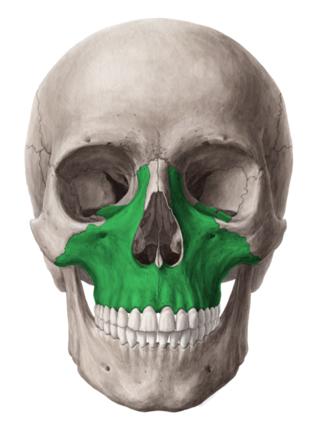 maxilla facepulling