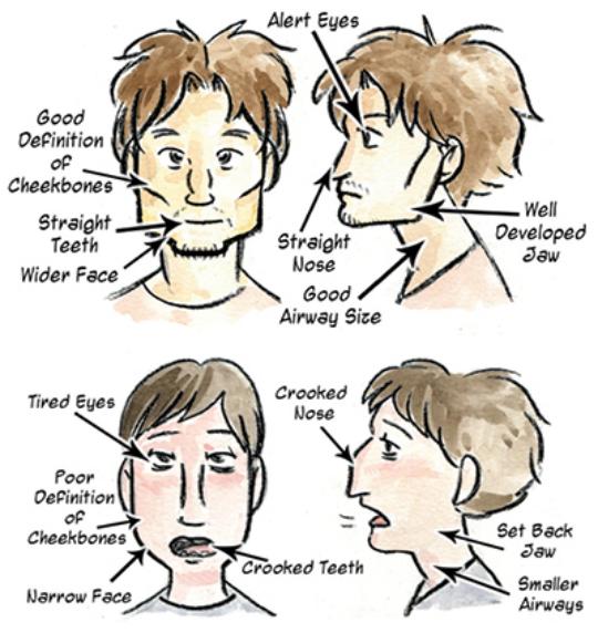 mewing before after results